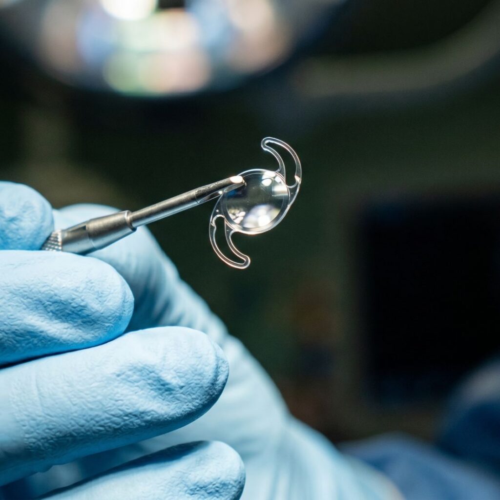 Close up of a surgeon wearing surgical gloves holding an instrument which is holding an intraocular lens